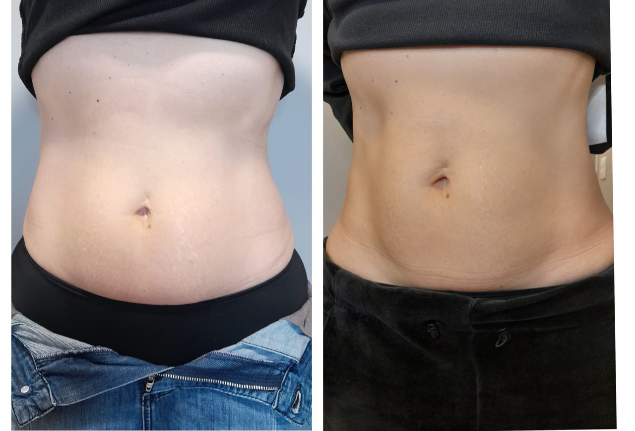 Projeto 14