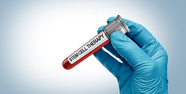 1-best-stem-cell-therapy-in-Mexico-(11).jpg