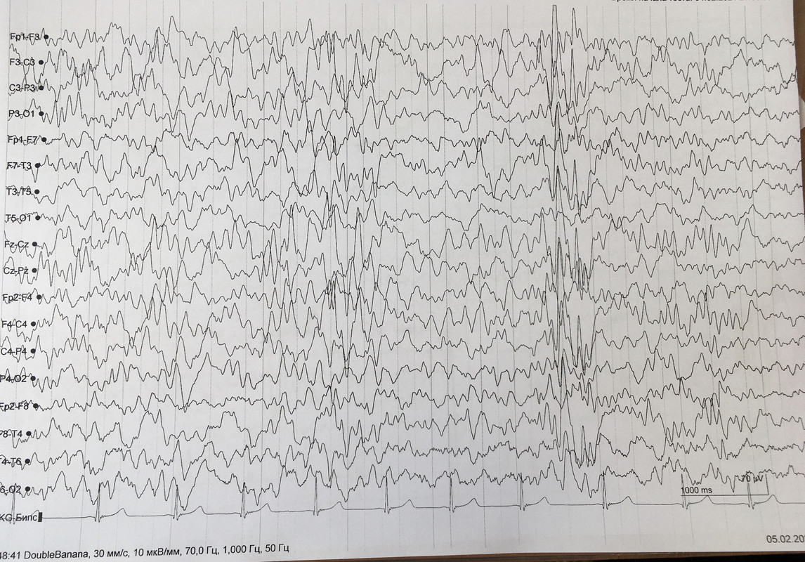 A8E43FA2-F796-428E-AEEA-31BCC6ACB96C