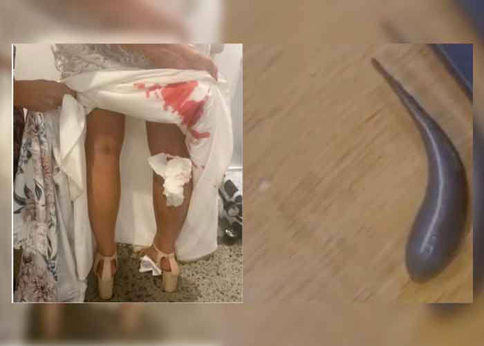 Novia se desangra en plena boda,todos se horrirazon al ver de que se trataba