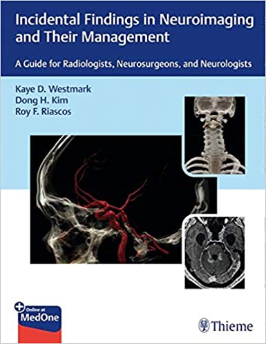 Incidental Findings in Neuroimaging and Their Management  A Guide for Radiologists, Neurosurgeons, and Neurologists