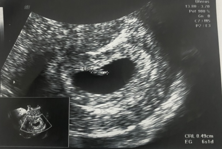 55D366CD-603A-4059-9F35-B33EF05C4A9D