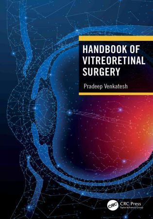 Handbook of Vitreoretinal Surgery (PDF)