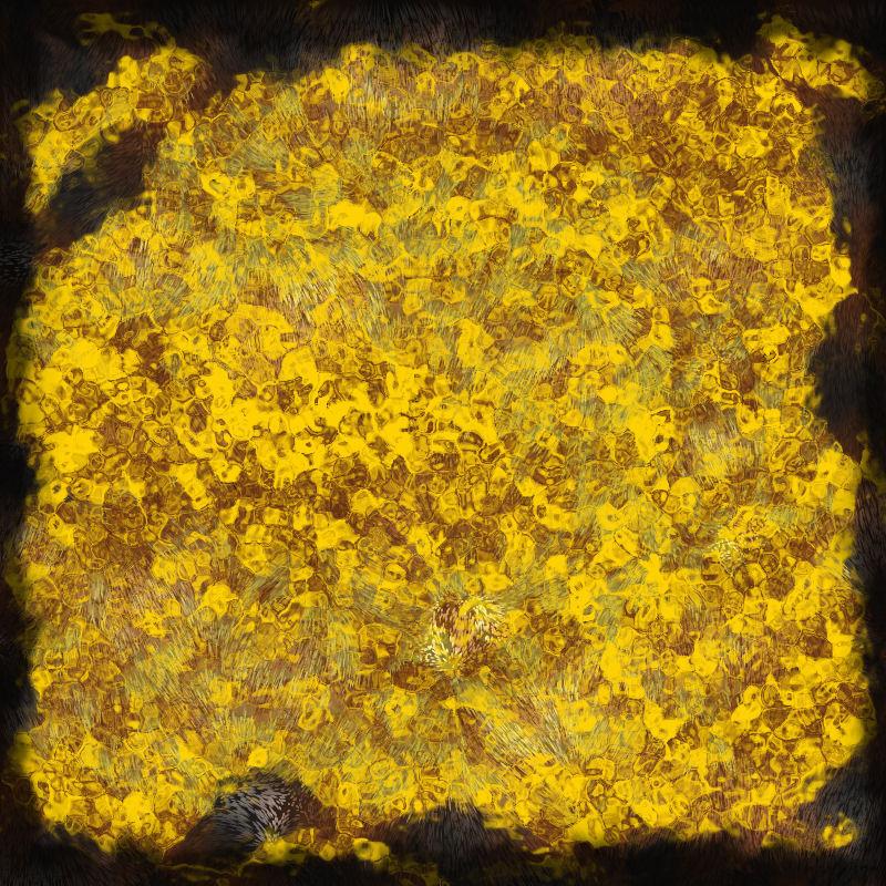 GBD_Lbp2