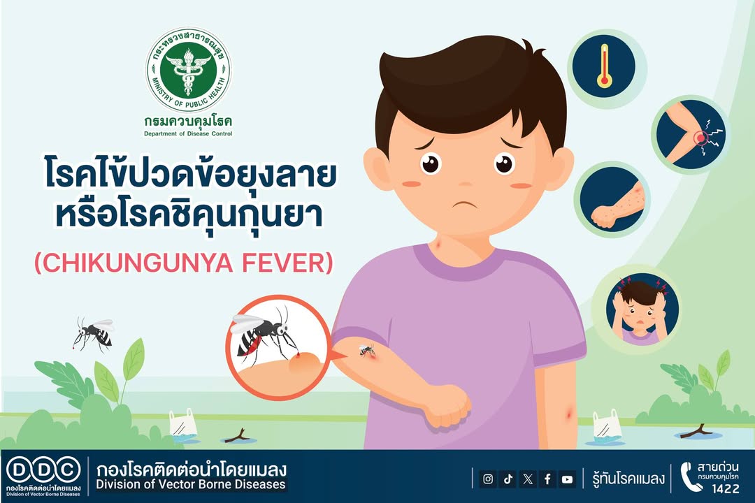 ชิคุนกุนยา