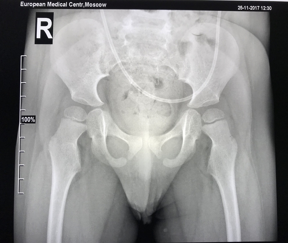 1133F469-2EFF-44A2-B4FA-3125BF47FA1F