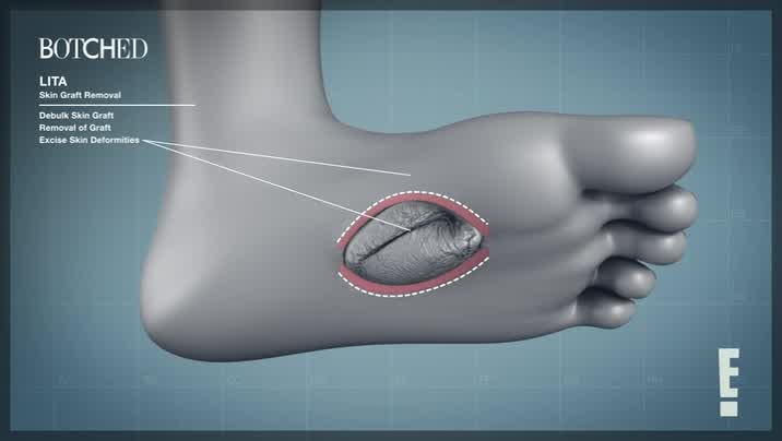 [Image: tgt7scpr24p8.jpg]