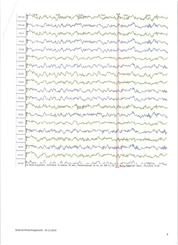 ЭЭГ 24.12.19 4.jpeg
