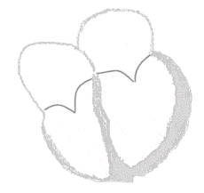 Heart-conduct-sinus.gif