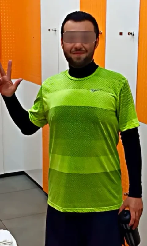 Patient after losing 48KG