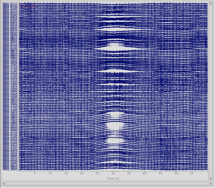 low voltage drift