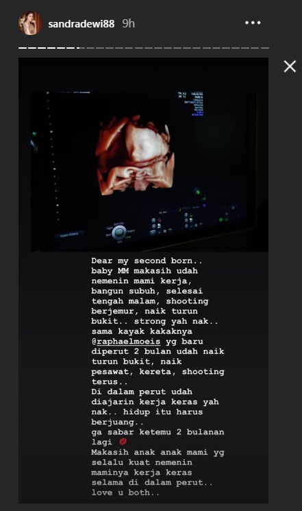 IG Story Sandra Dewi