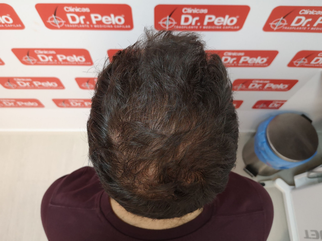 Revisión 8 meses (5)