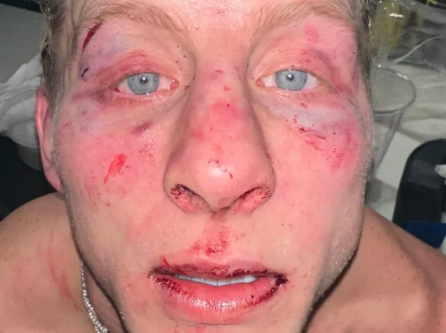 Дейна Уайт показа лицето на Пади Пимблет след UFC 324