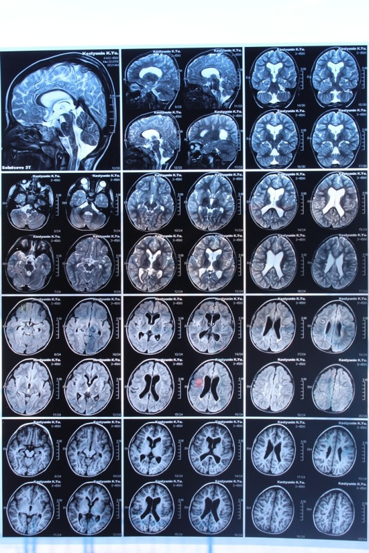 М?Т сжатый 8821