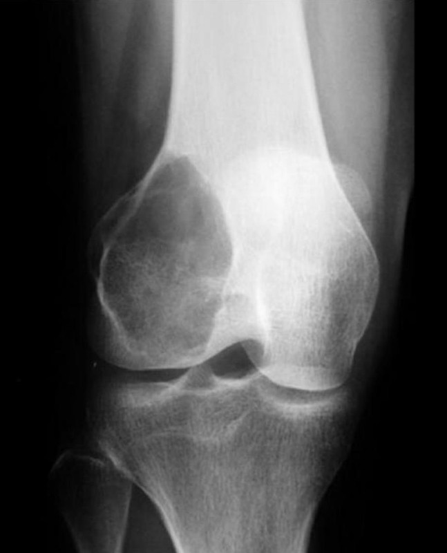 Oncology question 5 image