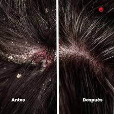 Antes y después cabello