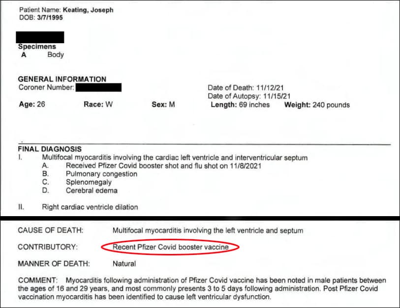 autopsy2
