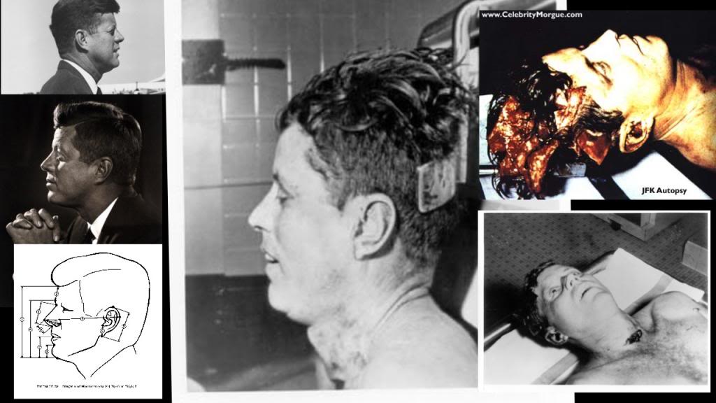 For instance here's Kennedy's neck creases which line up from fro...