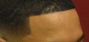 hairline.jpg
