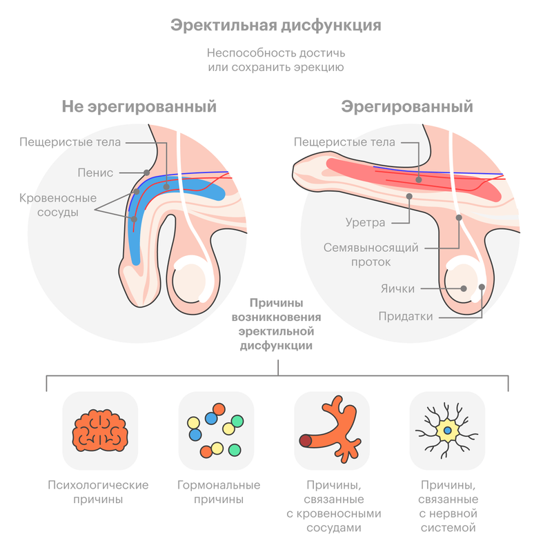 Эректильная дисфункция это причины Эректильная дисфункция это причины