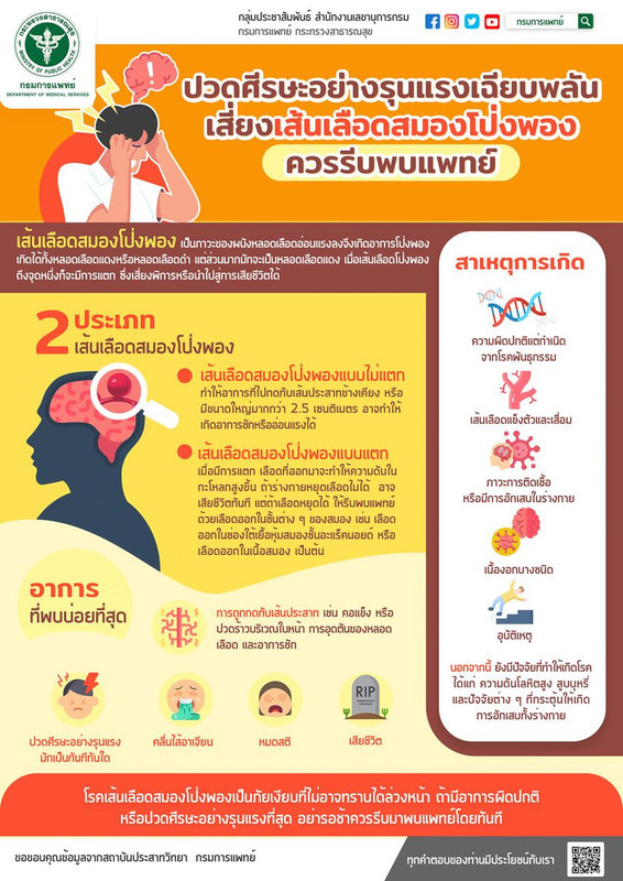 แพทย์เตือน ปวดศีรษะอย่างรุนแรงเฉียบพลัน เสี่ยงเส้นเลือดสมองโป่งพอง รักษาไม่ทันเวลาอาจรุนแรงถึงขั้นเสียชีวิต