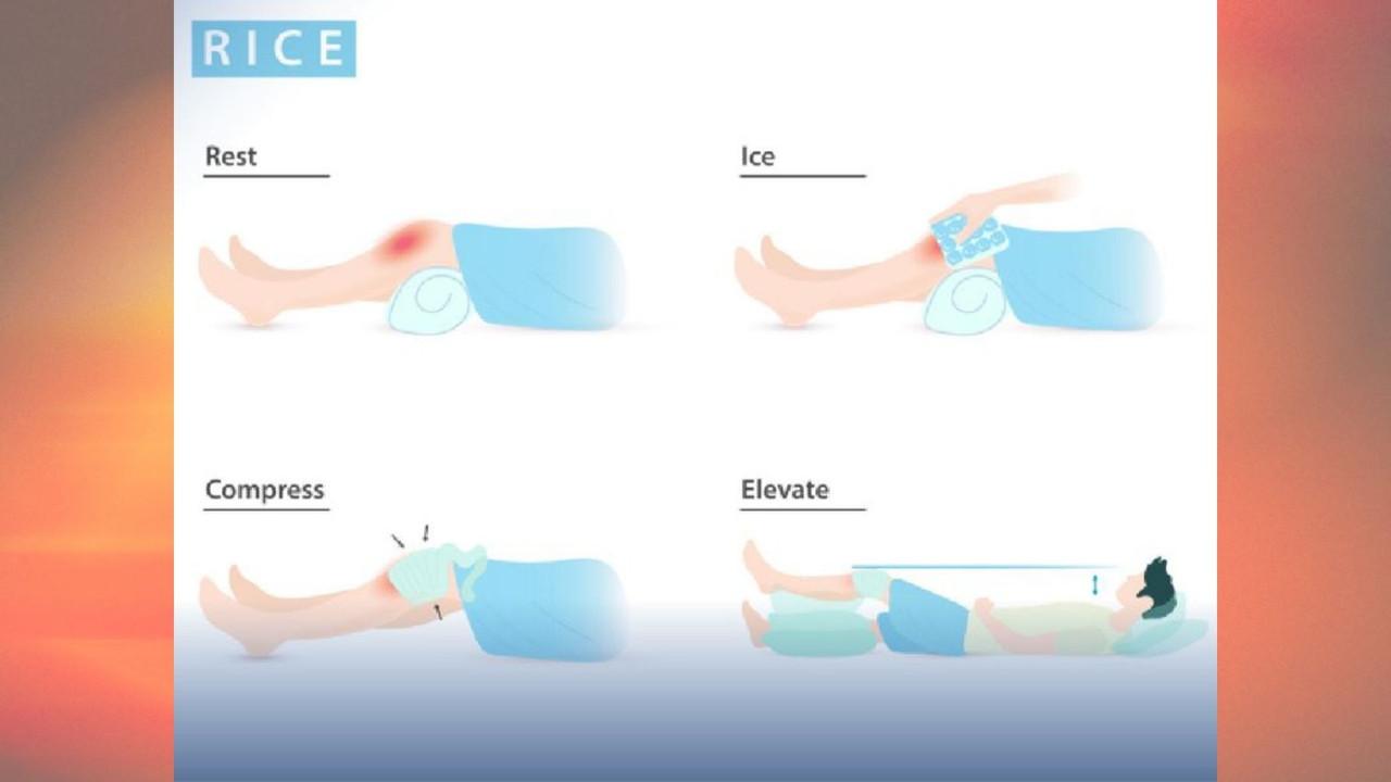 Infographic minh họa 4 bước RICE: Rest, Ice, Compress, Elevate xử trí chấn thương