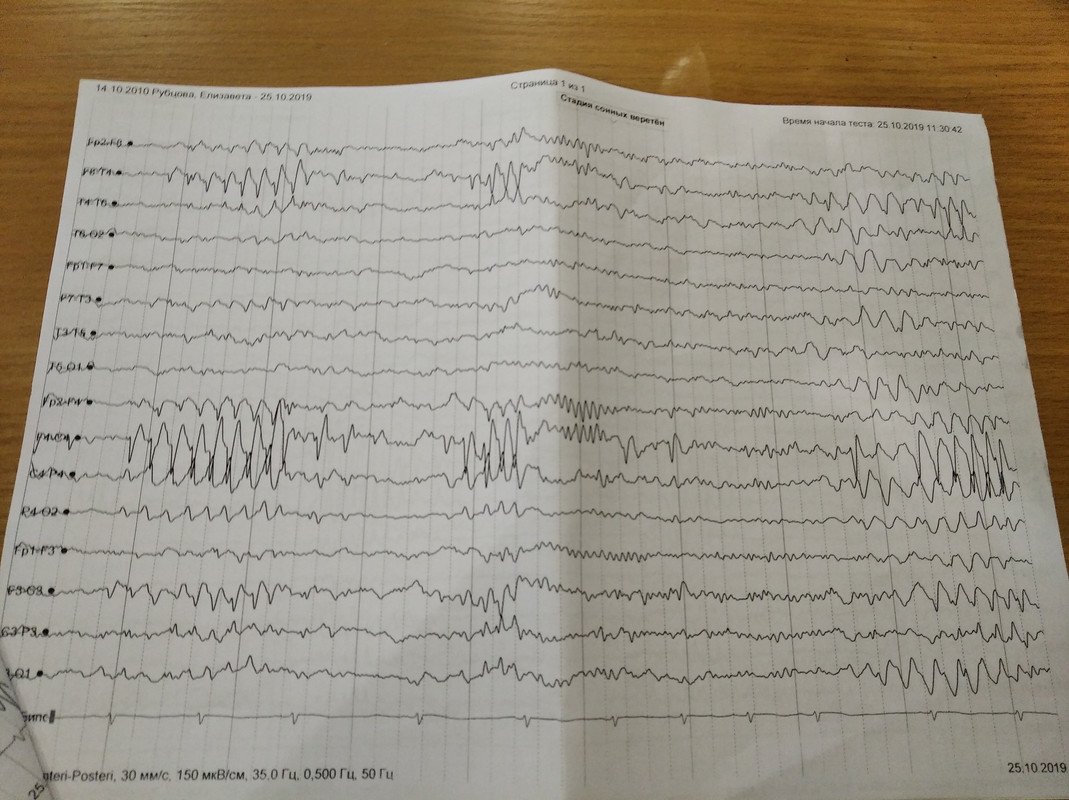 Ээг ребенку платно. ЭЭГ при коматозных состояниях. Направление на ЭЭГ. Эпи на ЭЭГ У детей. ЭЭГ пленка.