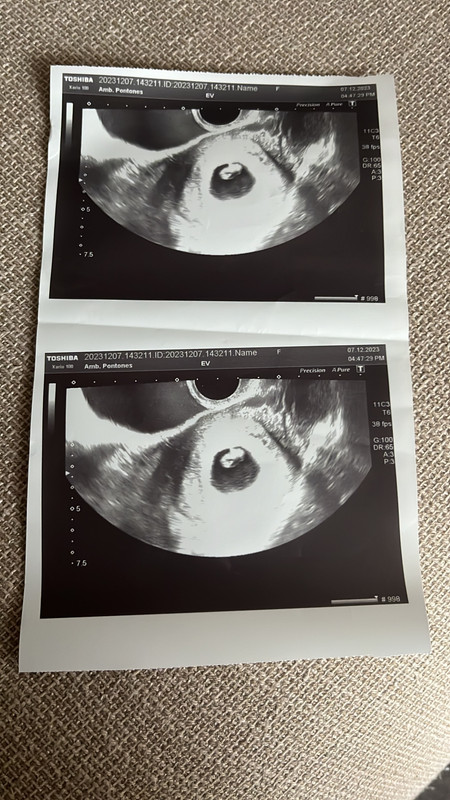 F4CDD5D8-2EF2-4E07-8456-D43F69AB132F