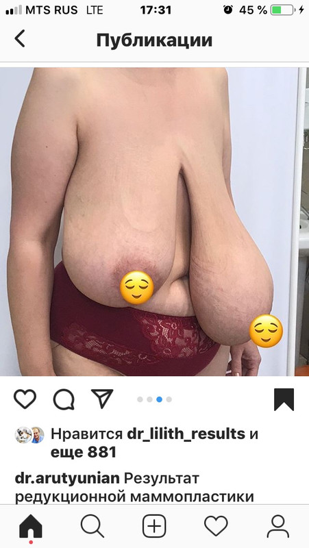 C88C8ABF-584E-40B5-A7C3-29818DC4D4D6