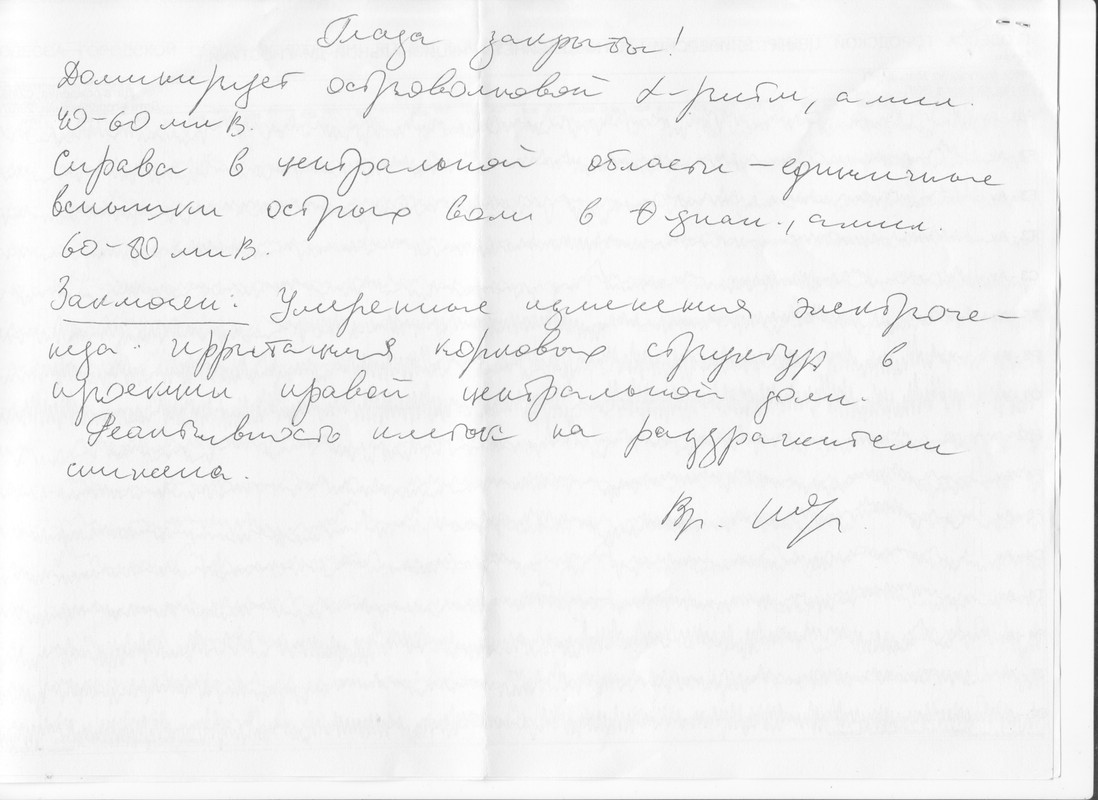 ЭЭГ дневн 29,07,19 -01