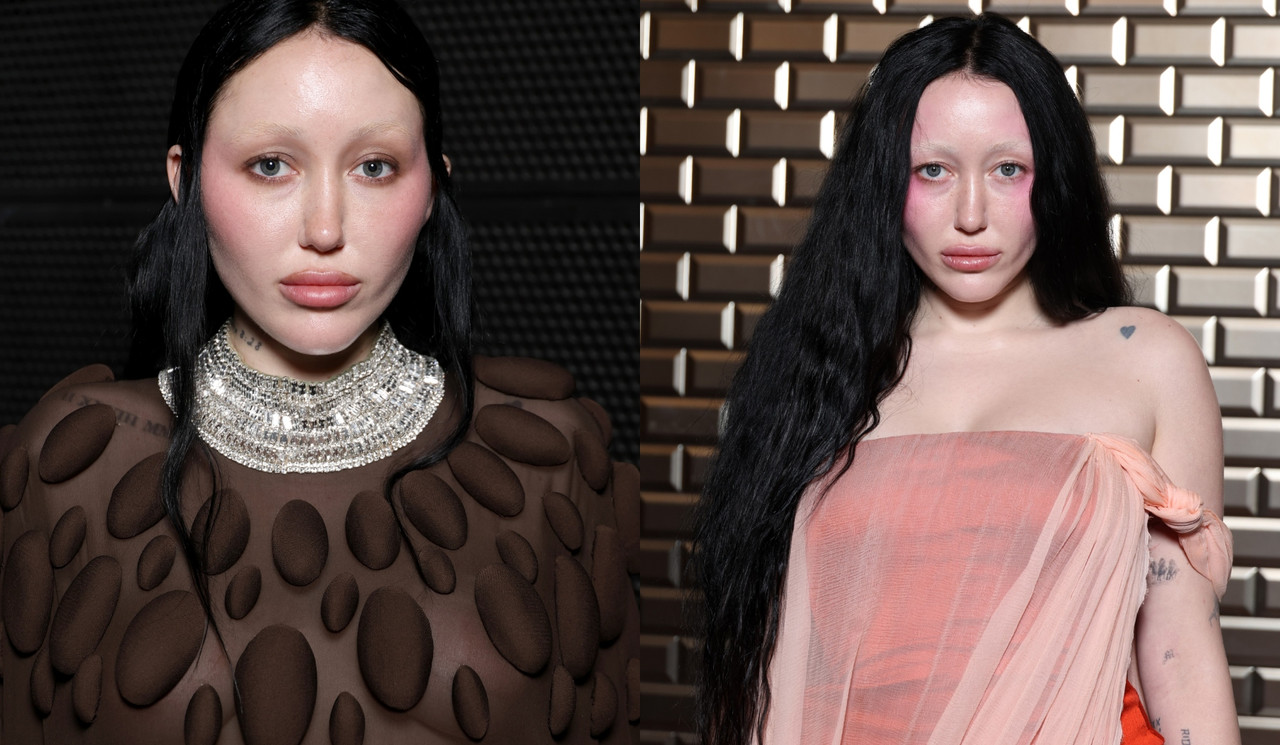 Noah Cyrus Plastic SurgeryBefore andAfterPhotos