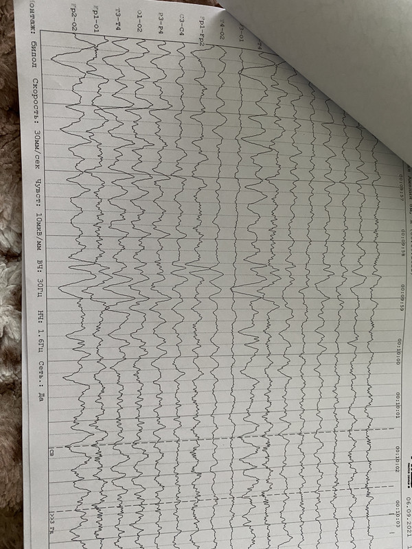 FB95A28B-8892-4EB5-A76B-3861FE499B02