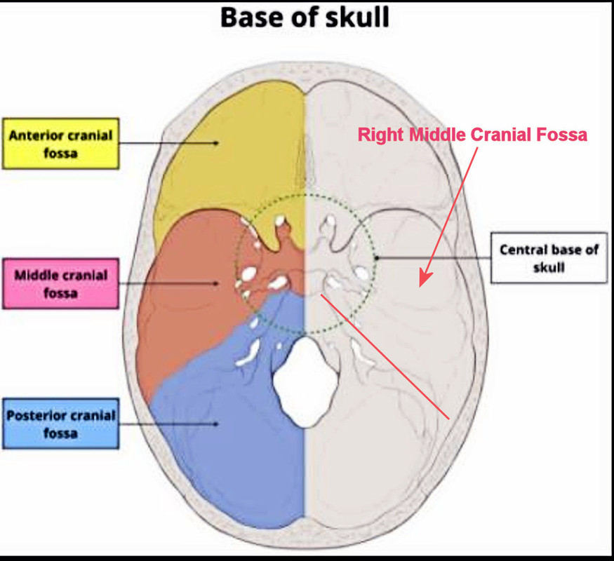 base-of-skull-bones-cranial-fossa-1.jpg