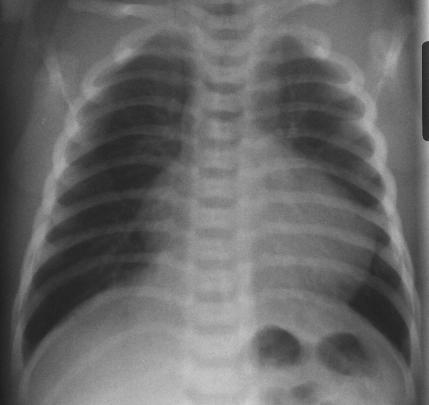 Pediatrics question 9 image