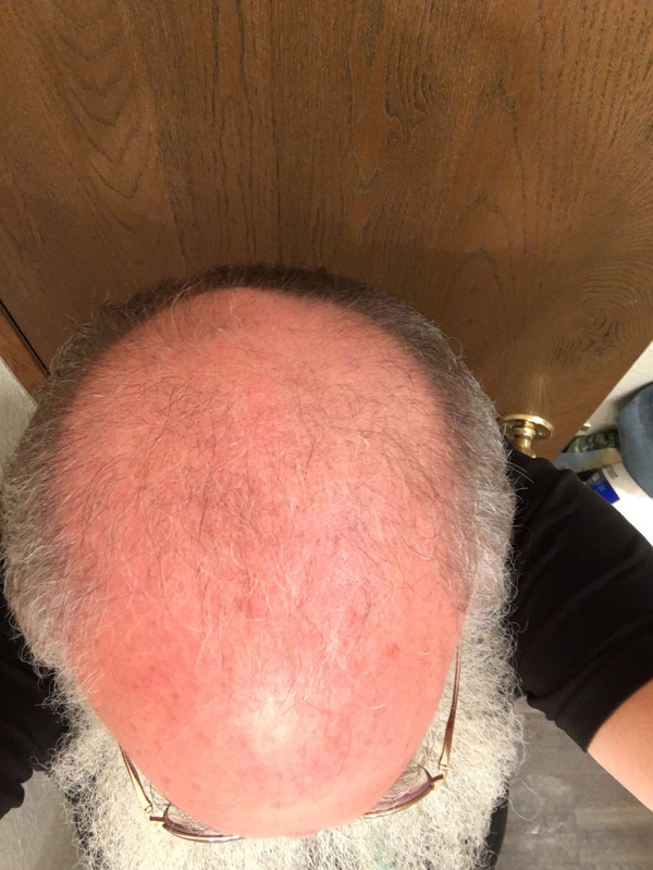 5AA06077-1A0B-46DB-849A-B3CA79E40DDE