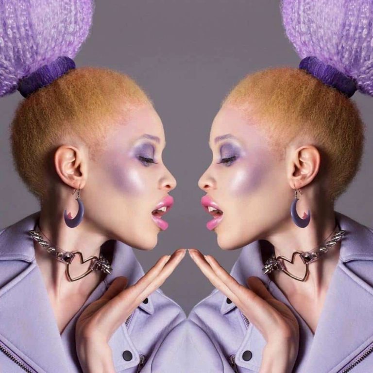 Афроамериканская модель с альбинизмом поразила всех своей необычной внешностью