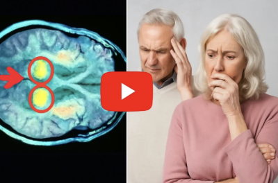 Brain scan with highlighted areas and worried couple