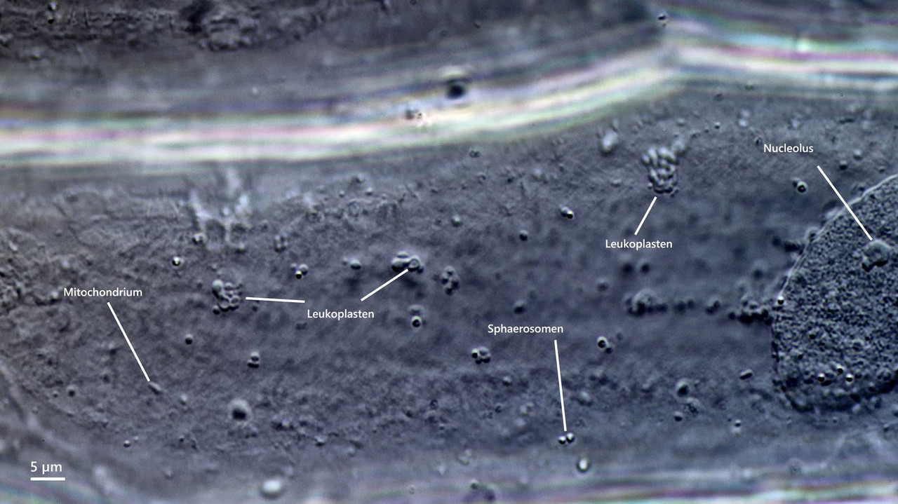 Zwiebel-Zelle 25 Weiße Allium cepa Zellkern Plastiden DIK 100-Z7