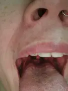 6-years-searching-for-diagnosis-just-found-multiple-v0-8sr3car8xyod1