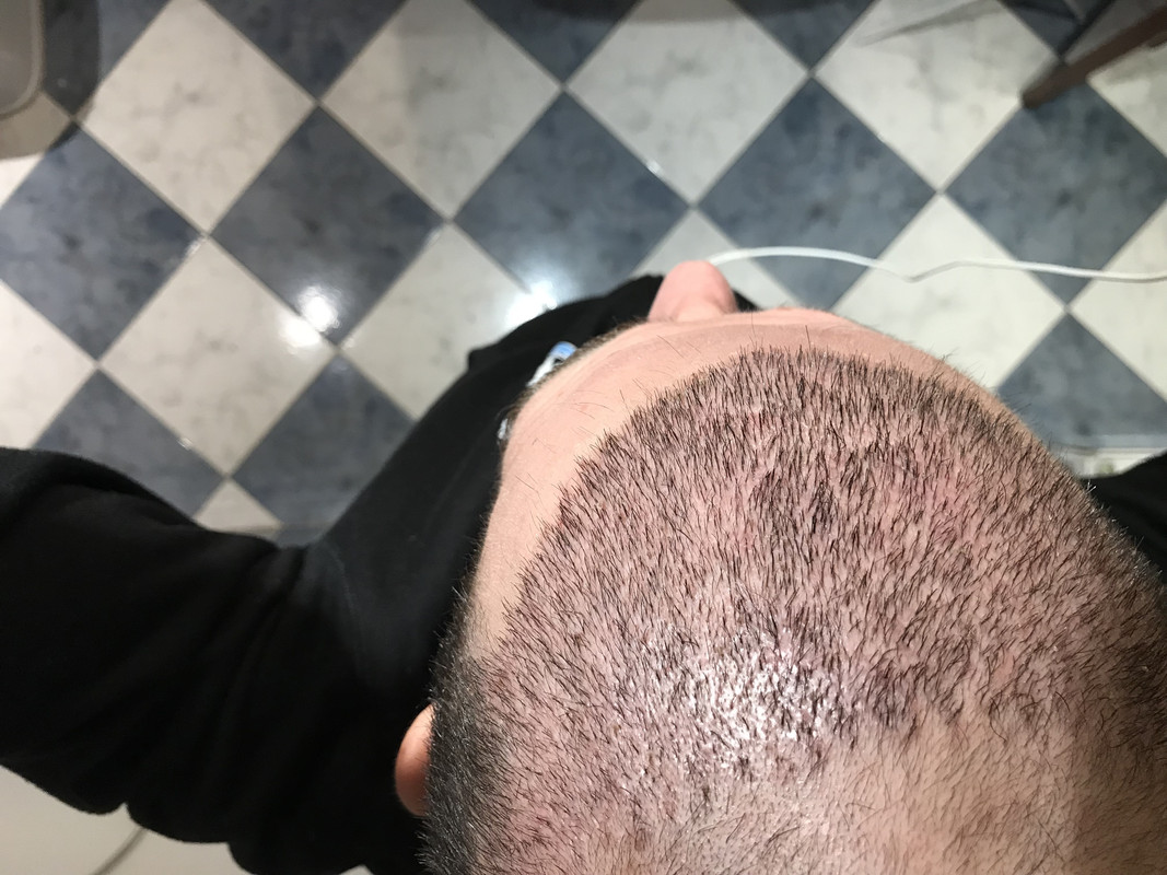 Foto 25-11-18 14 44 27