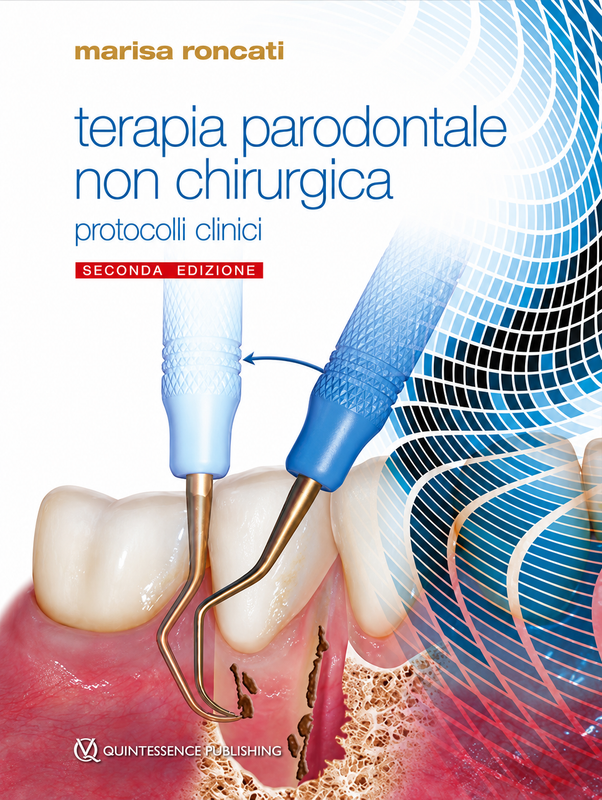 Terapia parodontale non chirurgica - SECONDA EDIZIONE