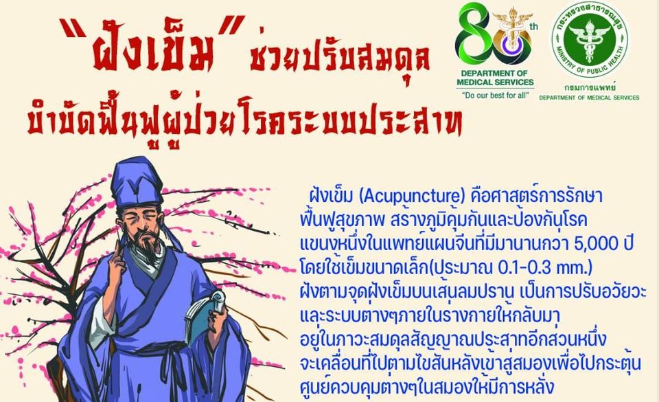 กรมการแพทย์แนะ ?ฝังเข็ม? ช่วยปรับสมดุล บำบัดฟื้นฟู ผู้ป่วยโรคระบบประสาท