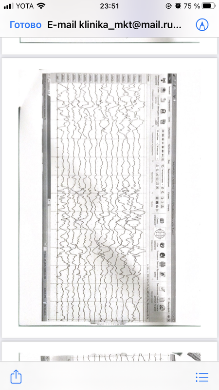 174ECE42-6175-4252-94D4-7C549445A679