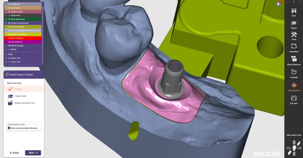 Exocad Tissue Adaptation | Dental Lab Network