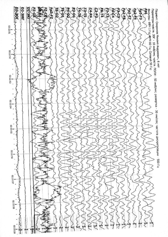 963873294b80479d965a30243f1151787COgqKfaoS7IG2sk-5
