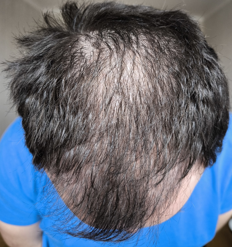 2025-03-26 09-44-37_1742976640006