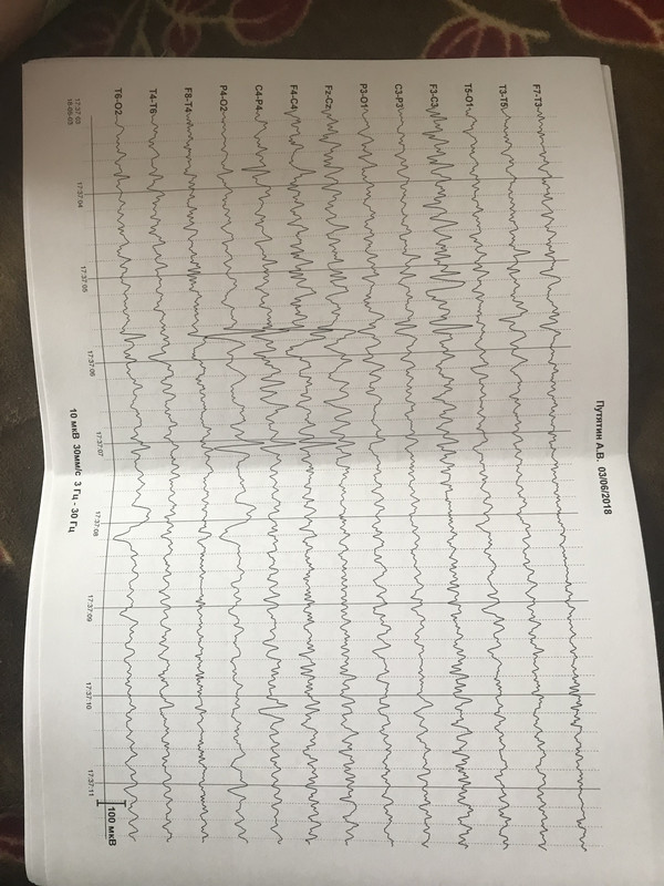 F1512D33-907C-4289-8F40-E25767C98841