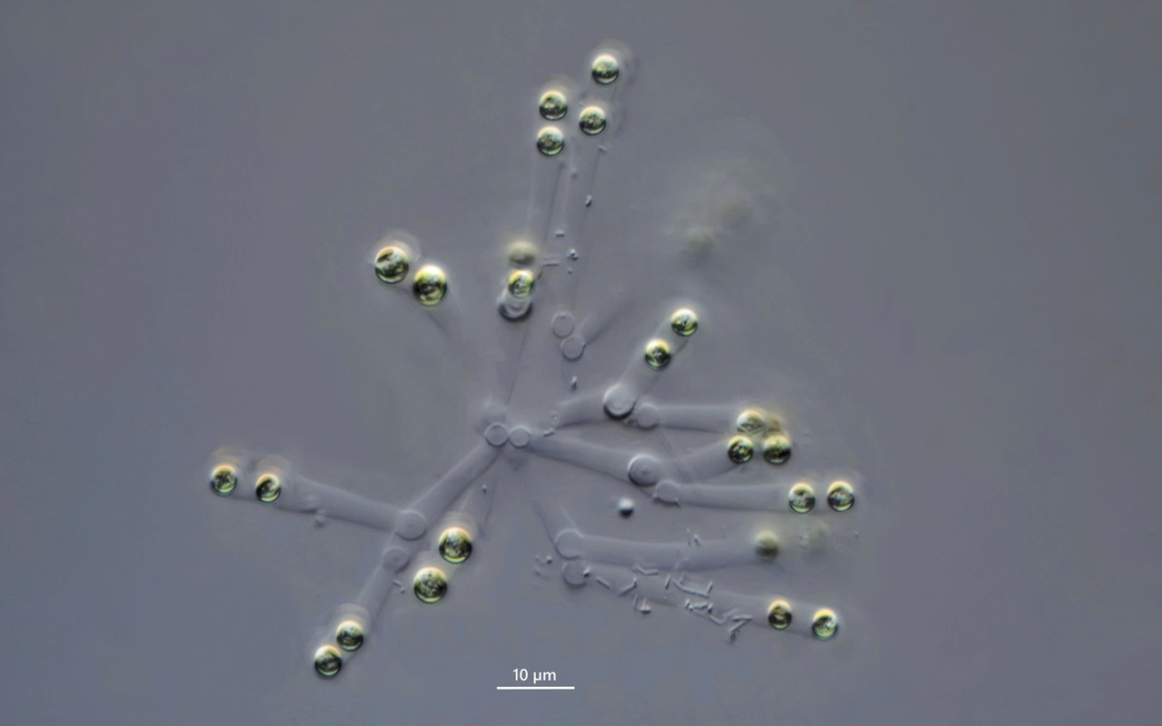 Dictyosphaerium 10  (ev) sp Gallertstrang-Alge DIK 100 Stack 4 Litzlau