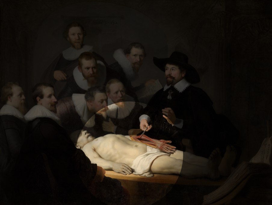 Dimanche 23 octobre 2022 Web1024-Rembrandt-The-Anatomy-3-png3